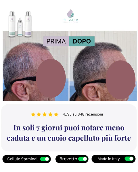 Efficacia dell'Integratore alla Mela Annurca per Capelli