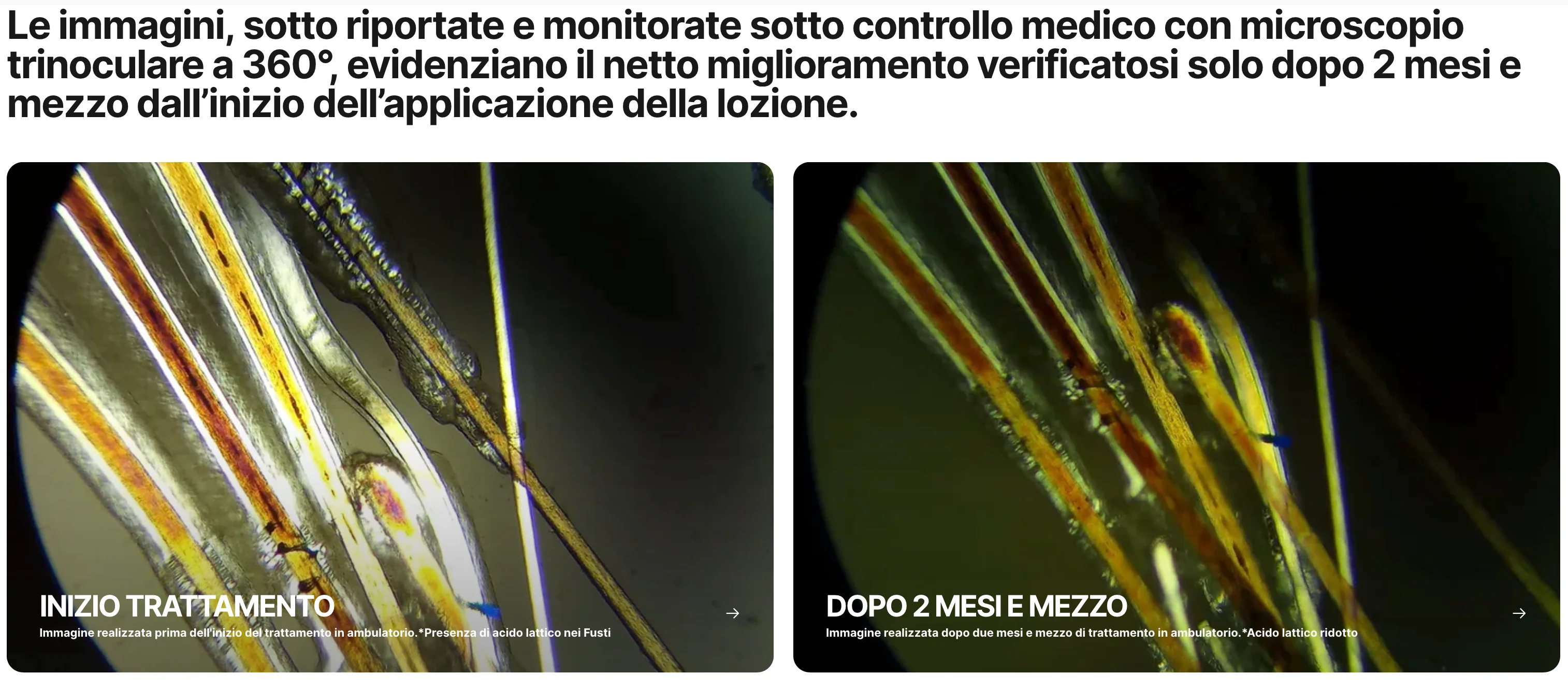 Miglioramento dopo 2 mesi di applicazione della Lozione Anticaduta